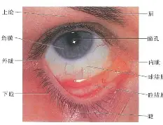九游体育下载app-疤痕眼睑退缩图片大全